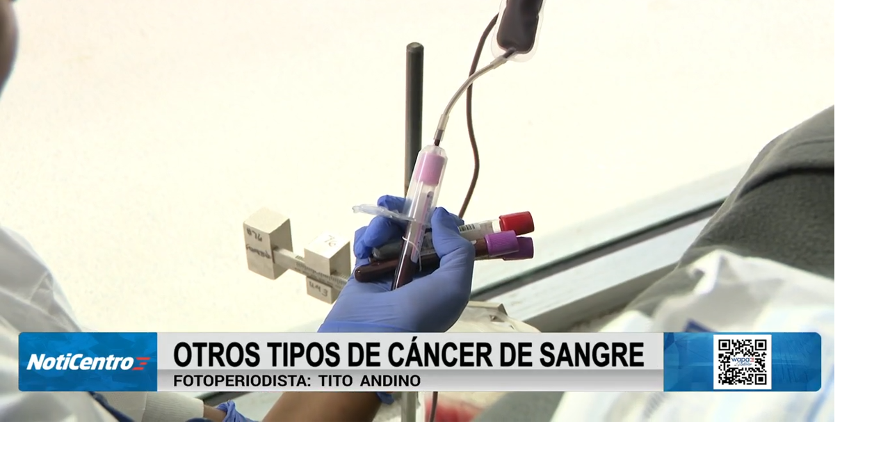 Síndromes mielodisplásicos: un cáncer en la sangre que afecta mayormente a mayores de 60 años