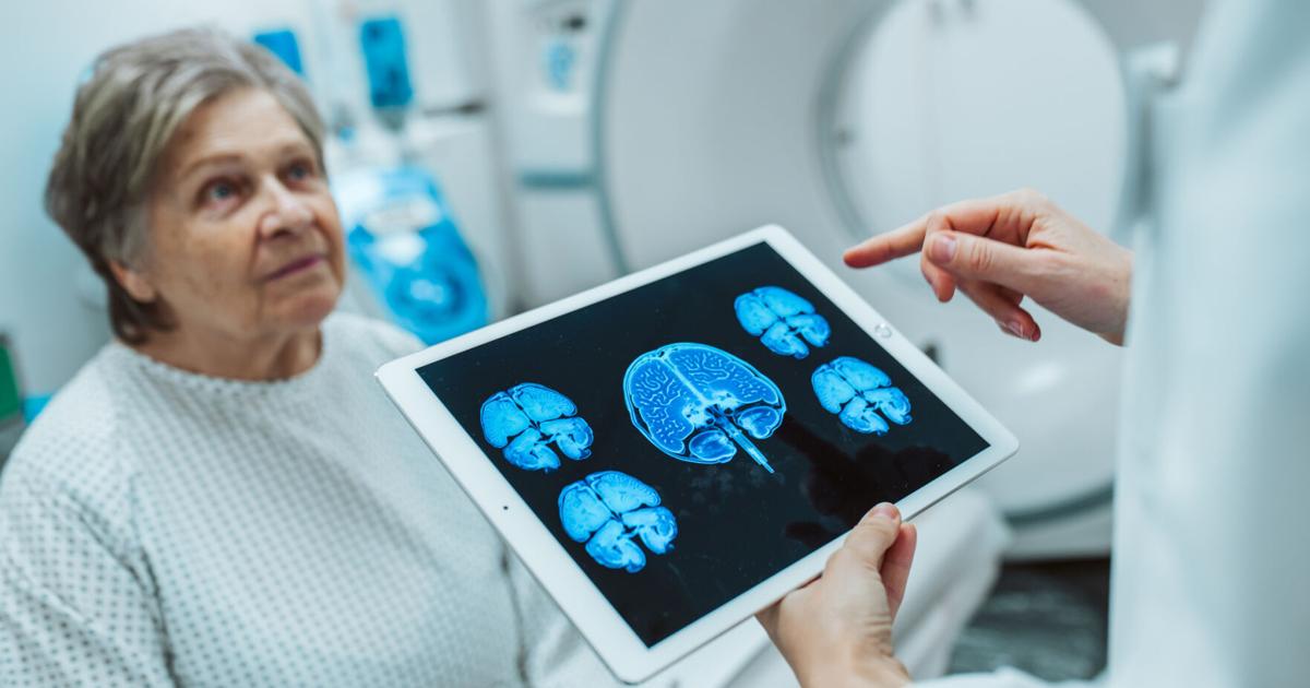 Demencia frontotemporal afecta tanto a jóvenes como adultos mayores