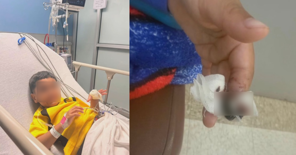 Niño de 5 años pierde parte de su dedo en incidente escolar en Guayama