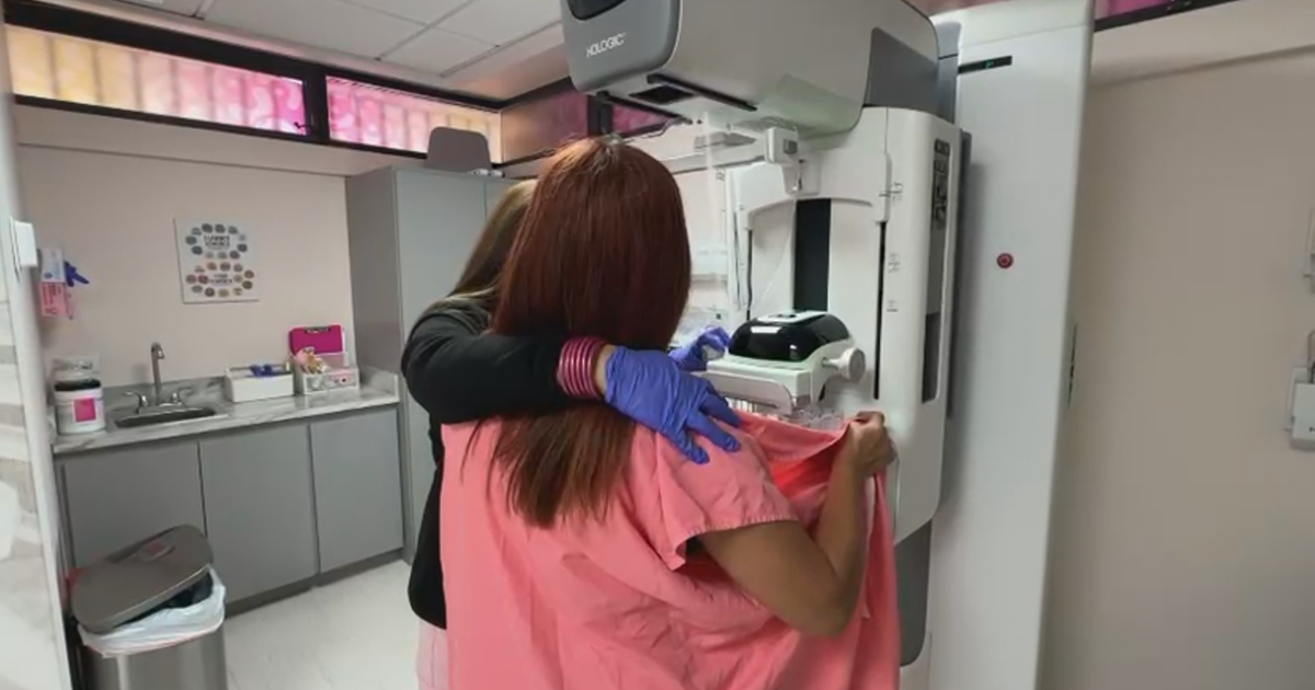 Tomosíntesis e inteligencia artificial mejoran detección temprana del cáncer de mama