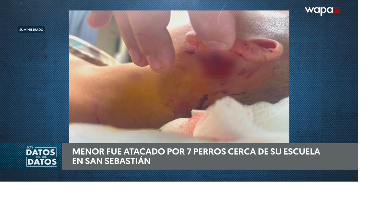 Madre denuncia brutal ataque de perros contra su hijo en San Sebastián