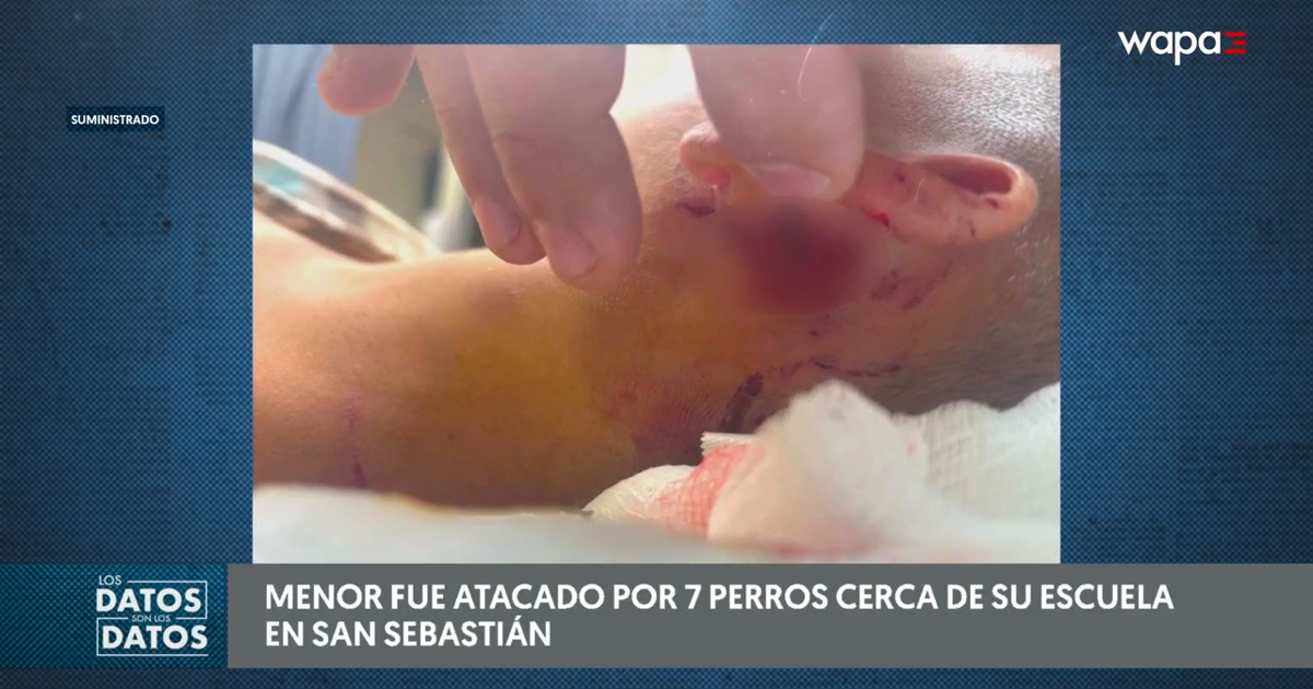 Madre denuncia brutal ataque de perros contra su hijo en San Sebastián