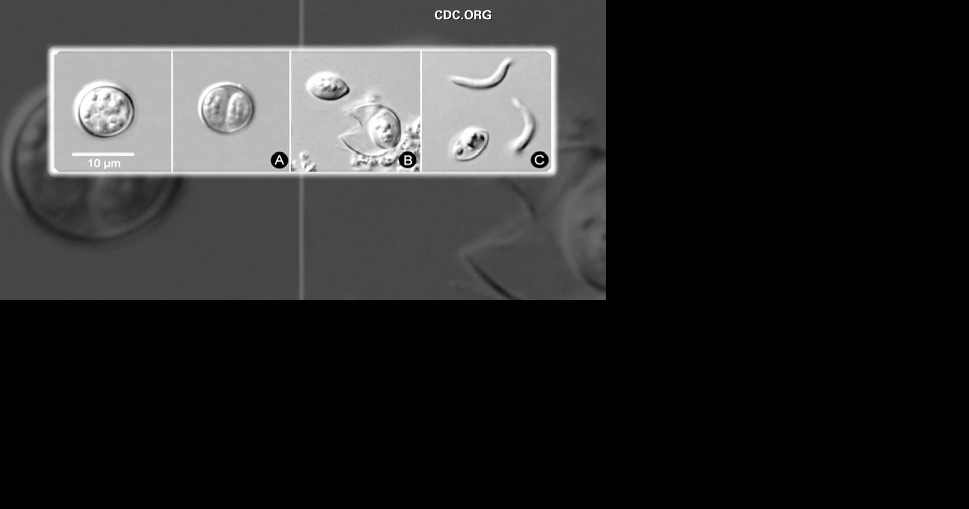 Salud confirma primer caso de ciclosporiasis en Puerto Rico en viajero internacional