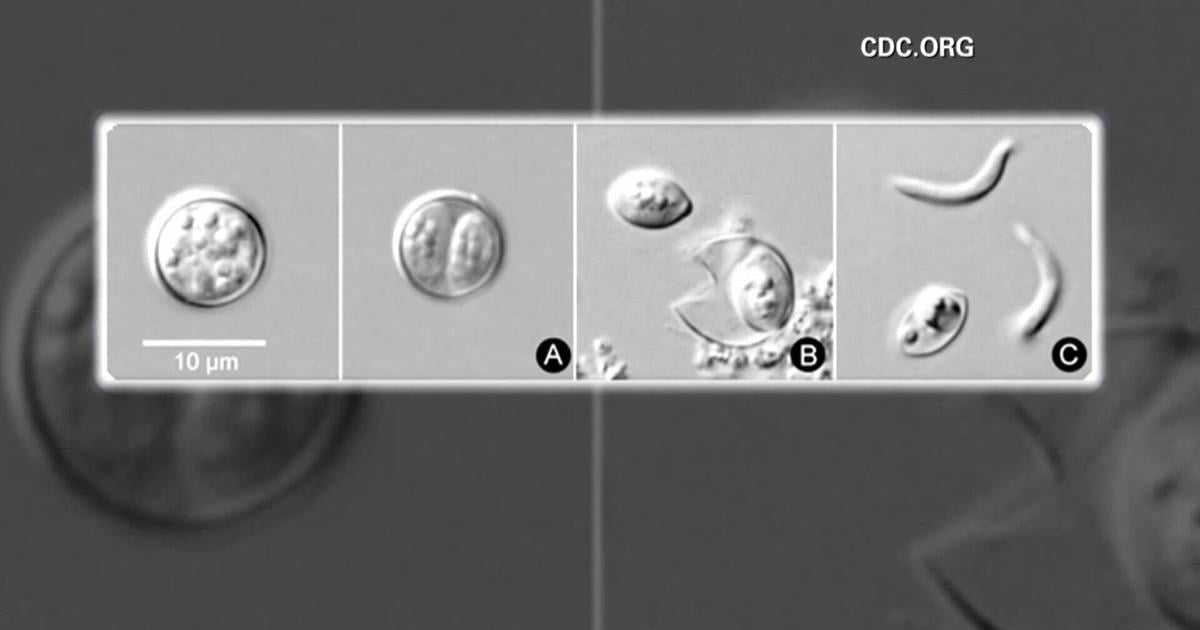 Salud confirma primer caso de ciclosporiasis en Puerto Rico en viajero internacional