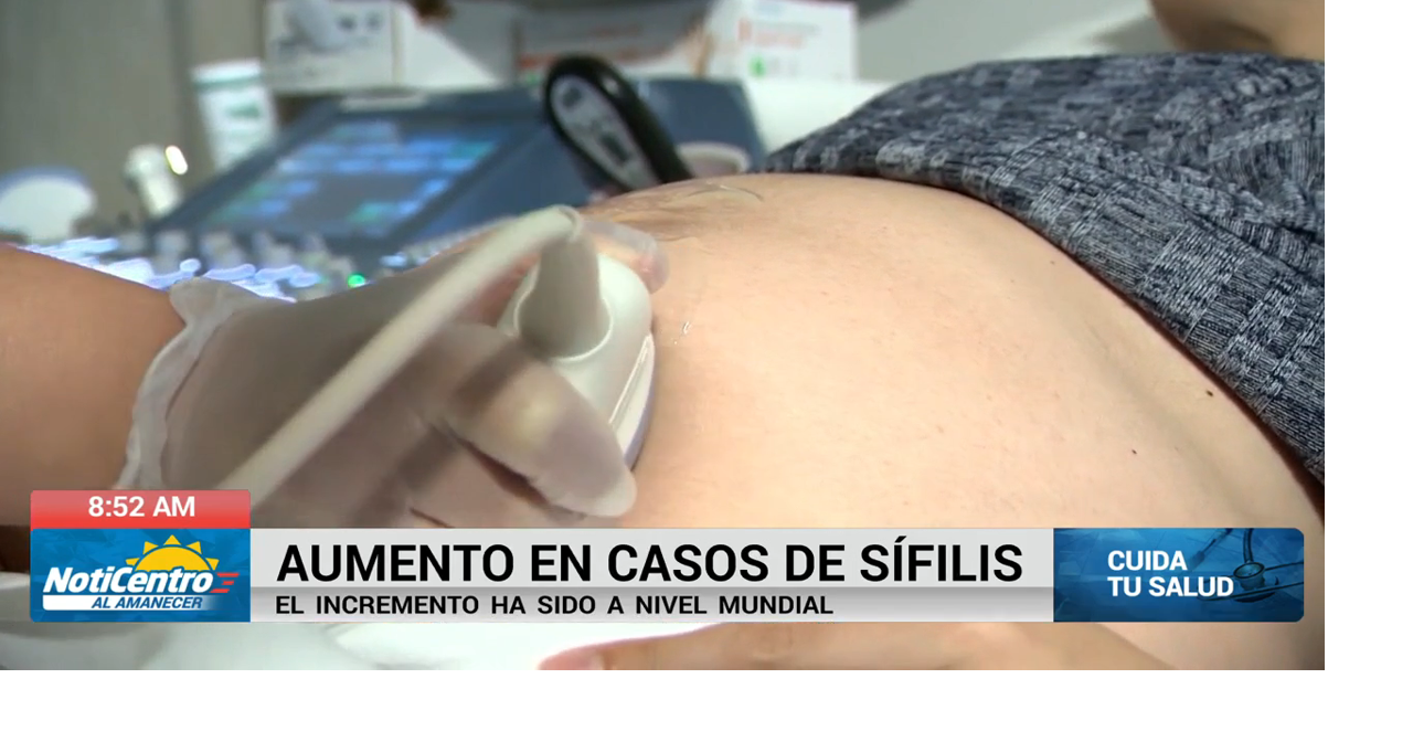 Reportan aumento en casos de sífilis a nivel mundial
