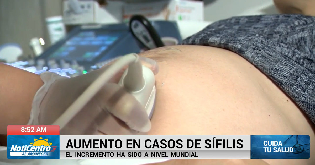 Reportan aumento en casos de sífilis a nivel mundial