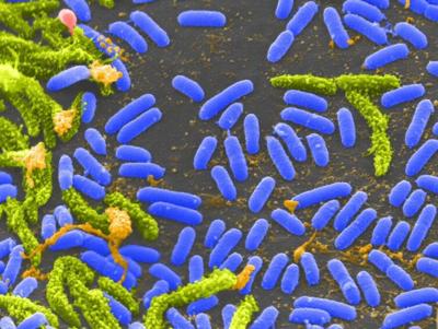 Closeup of Vibrio bacteria 