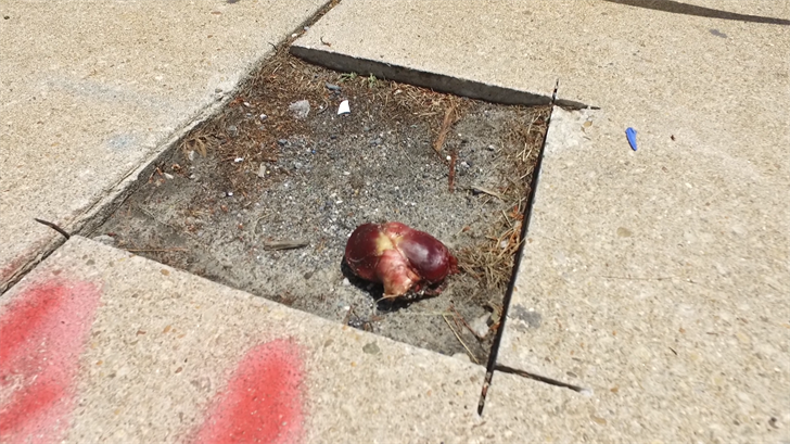 Organ Found On Sidewalk Outside of Peninsula Regional Medical Center
