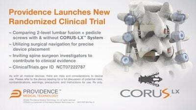 First Subjects Randomized in Clinical Trial Evaluating the Benefits of Total Segmental Fusion in Treating Degenerative Conditions in the Lumbar Spine