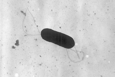 Prepared Food Listeria Outbreak