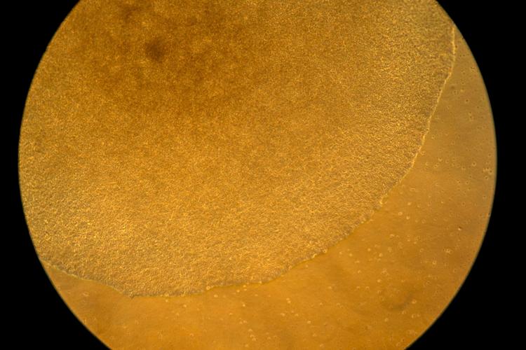 Autoimmunity New Treatments