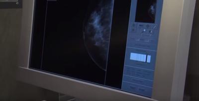 paid-content-by-peninsula-regional-medical-center-mammography-misconceptions-youtube