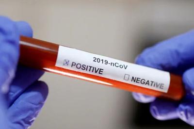 TESTS POSITIVE FOR COVID
