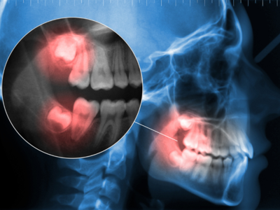 Emergency Dentist Perth Addresses Urgent Toothache Care for Local Patients