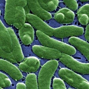 Watermen Question Vibrio Increase