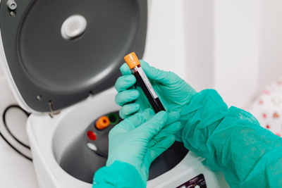 Stem Cell Transplantation and Its Role in Modern Leukemia Treatment