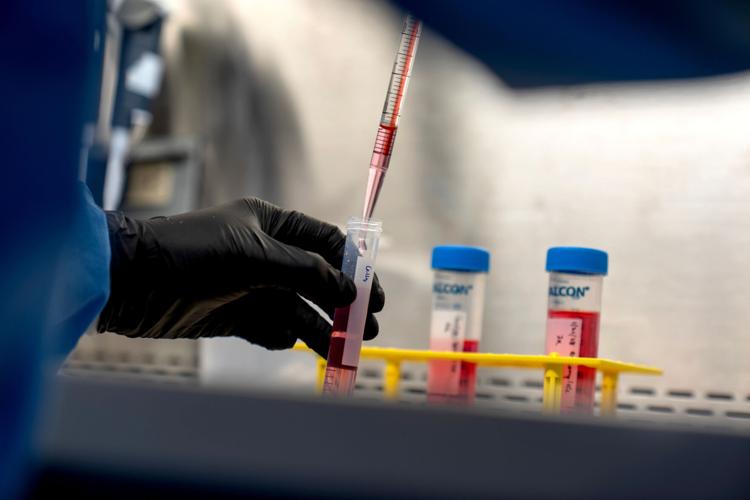 Autoimmunity New Treatments