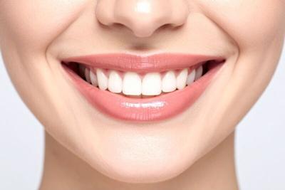 Best Teeth Whitening Kits in the US Research Report Published by HartwellResearch.com