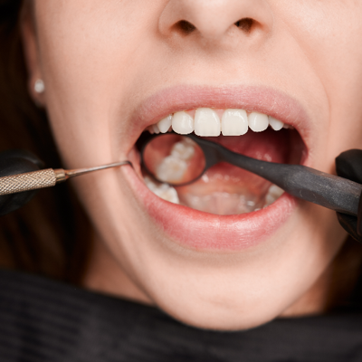 South Rock Dental: South Surrey's Trusted Dentists