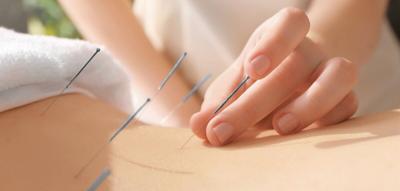Acupuncture Clinic in Culver City Offers Fertility and Pain Relief Care