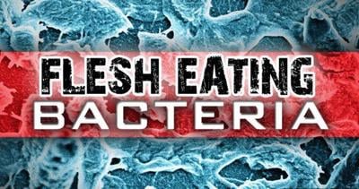 Mom Says Son Infected With Flesh-eating Bacteria After Swimming in West OC