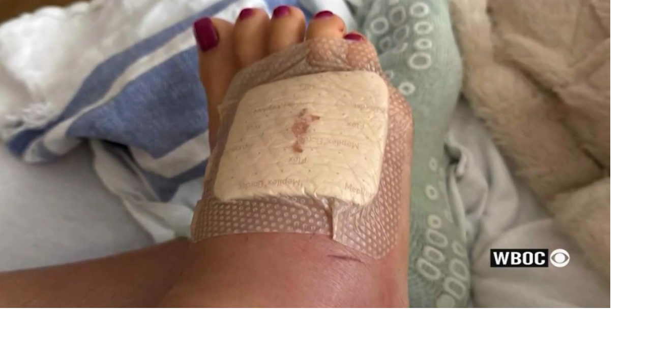 Doctors Warn Of Flesh-Eating Bacteria