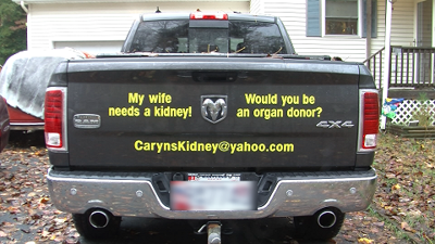 web kidney pic