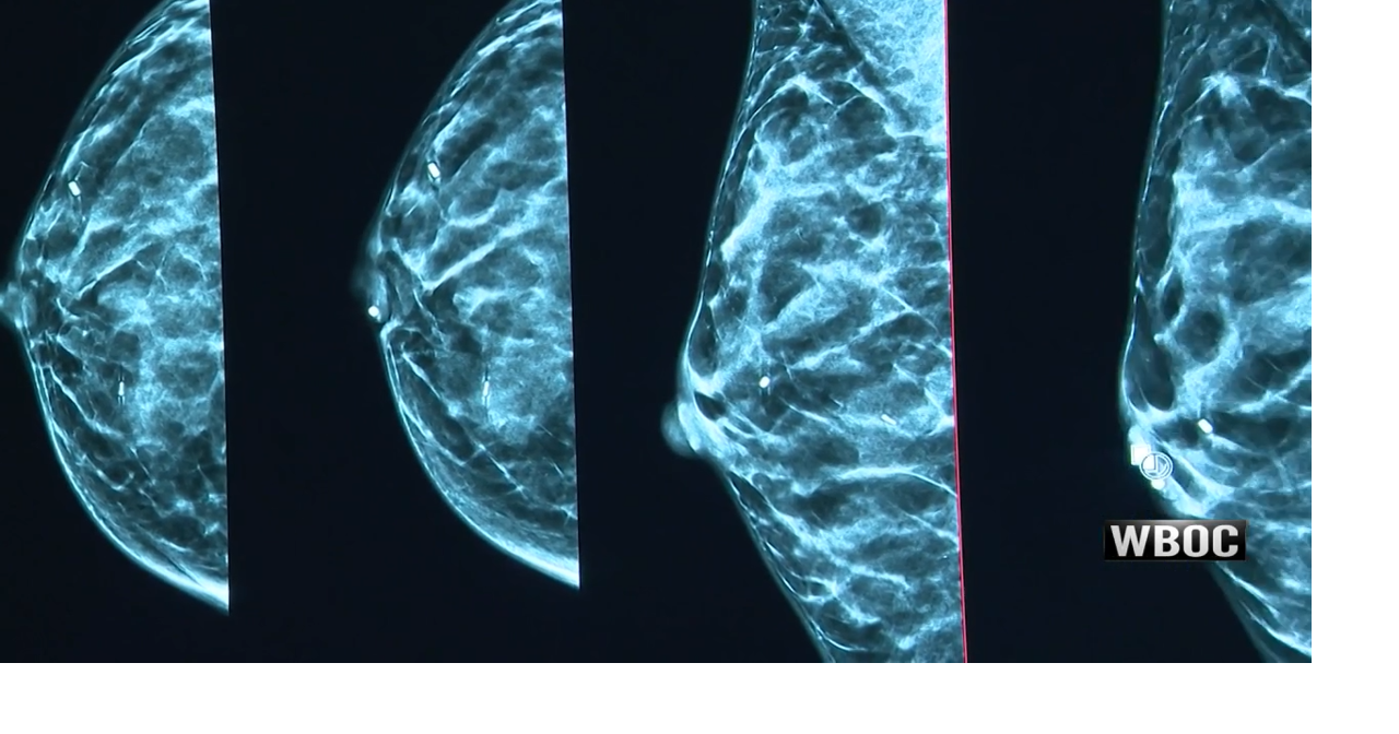 Research Suggests Some Breast Cancers May Be Overtreated