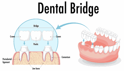 New Windsor Dental Practice Offers Bridges, Implants & Cosmetic Care