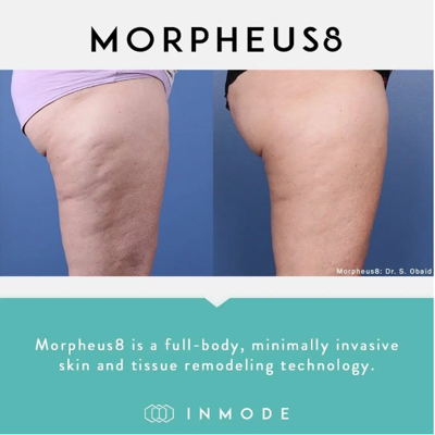 The Med Spot Highlights Non-Surgical Body Contouring Ahead of Holiday Season
