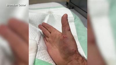Shark Bite