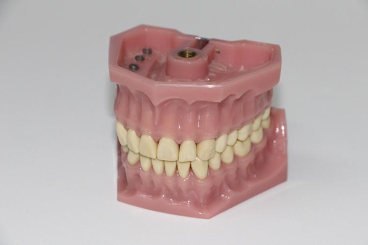 dentures-1514697_1920