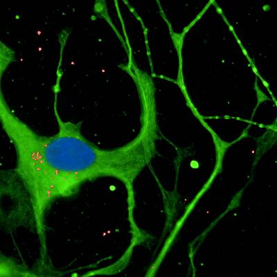 CE-Ventures Backs Aptadir Therapeutics in €40 Million Seed Round, One of Europe’s Largest in Biotech