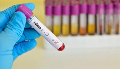 Rabies positive test