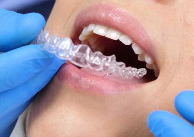 Redmond Dental Office Offers Invisalign, Implants & Sedation