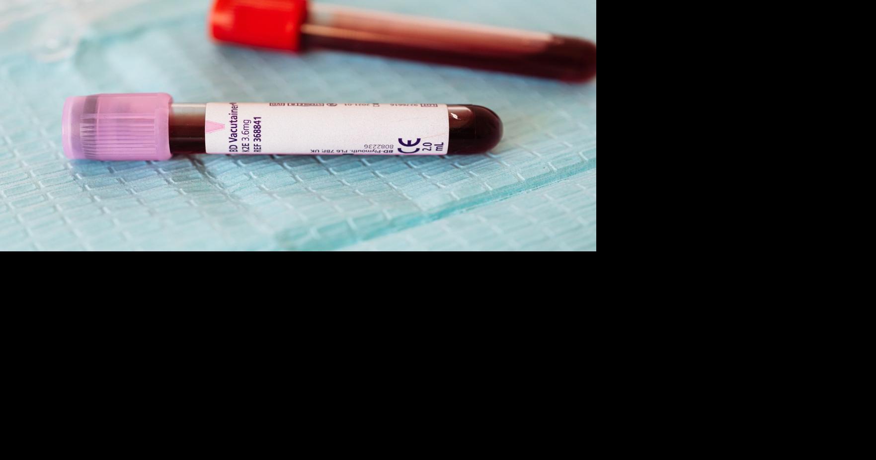 blood work medical labsvilesblood