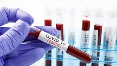 Coronavirus live updates: Coronavirus live updates: 18 states in 'red zone' for COVID cases, WH document shows