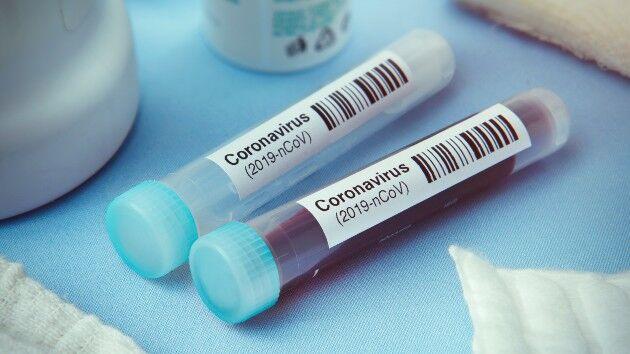 Coronavirus Live Updates Eli Lilly To Supply Us With 300 000 Vials Of Antibody Drug National Wcsjnews Com