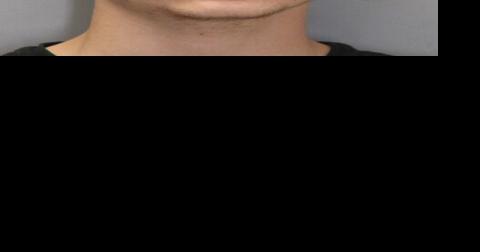 Arrest made in parking lot altercation - Vimarsana News