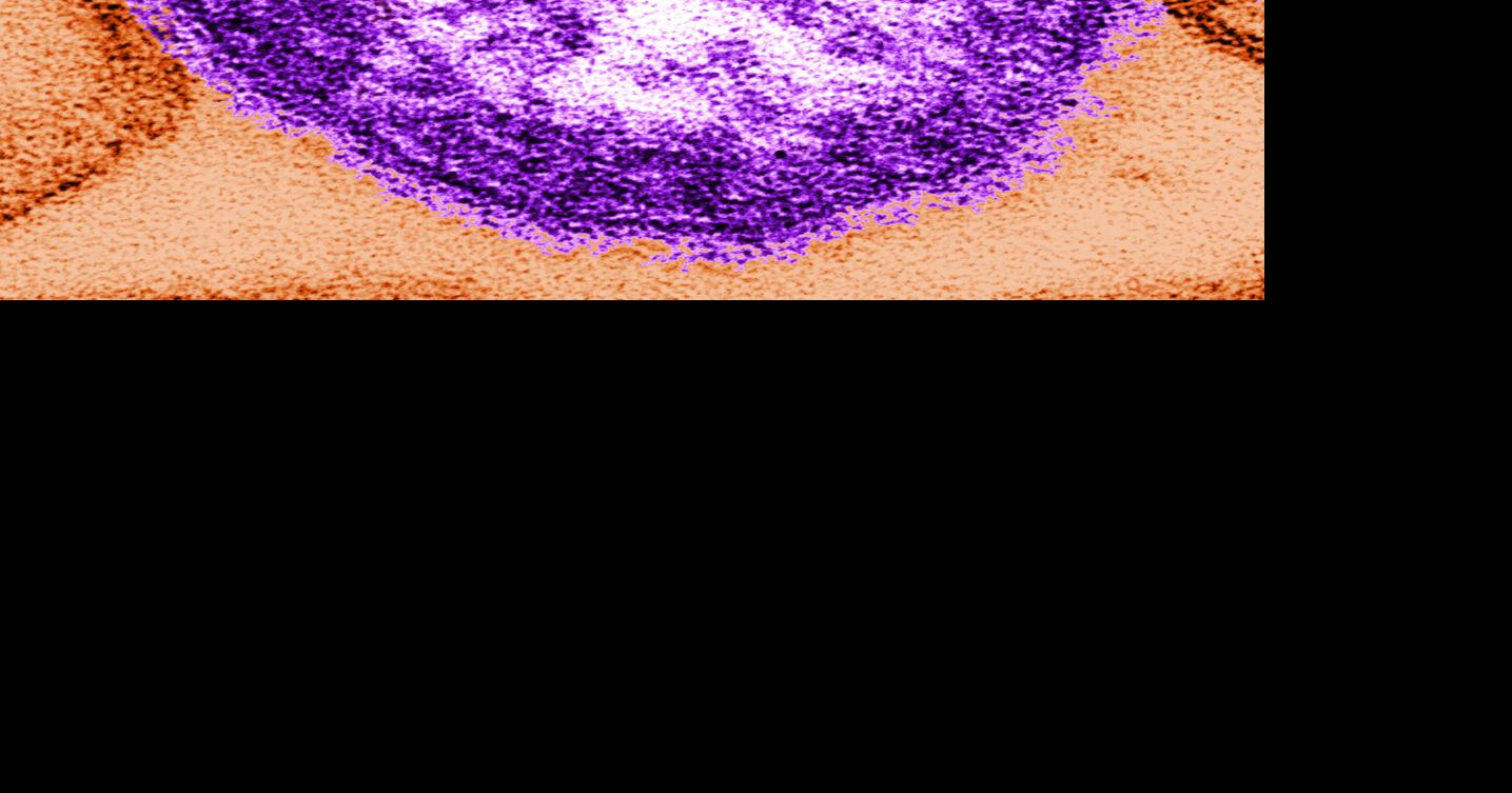 Measles exposure reported at Nemours Children's Hospital