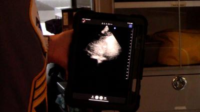 NCC EMS ultrasound
