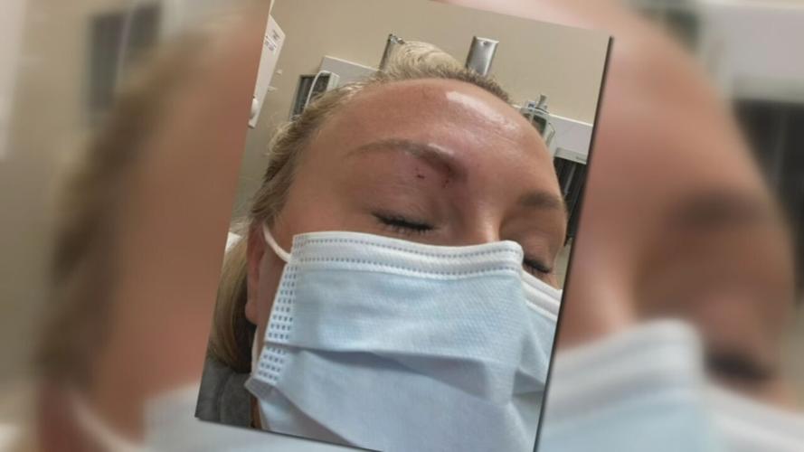 SNAKE BITES KY WOMAN IN FACE - 6-22-2022  (1).jpeg