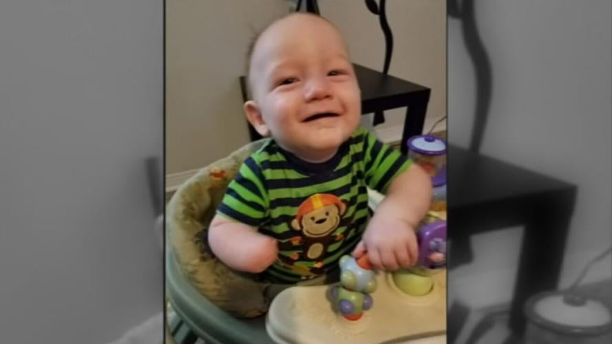 Glasgow boy with 3D hand