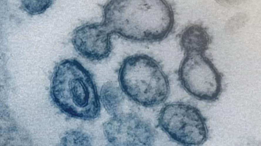 CORONAVIRUS - GENERIC FILE GRAPHIC - LAB - AP.jpg