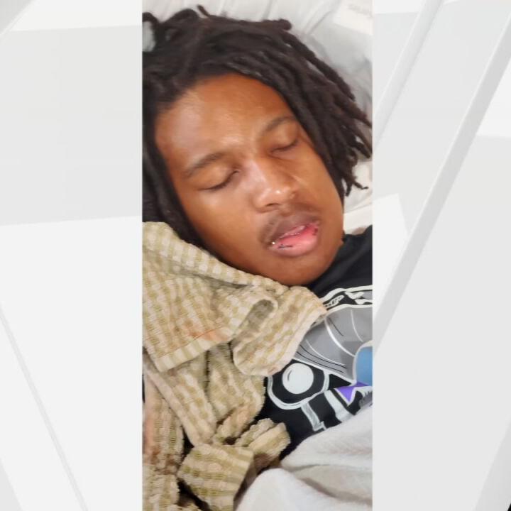 My son's jaw is wired shut': Louisville mom says her son broke jaw during  fight at JCPS school