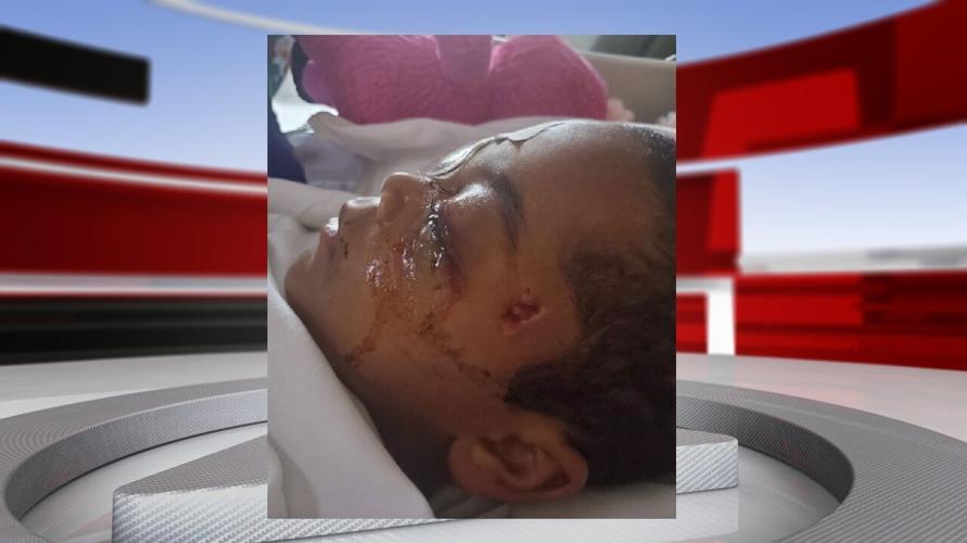 Malakai Roberts after being shot in the head.jpg