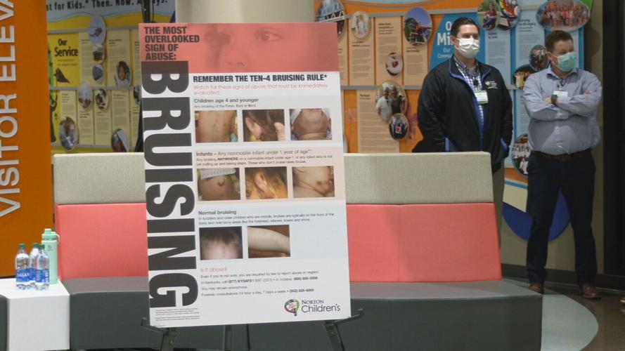 Signs of Child Abuse at Norton Children's Hospital