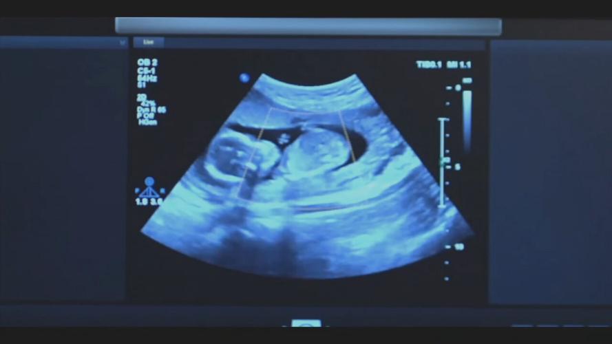 Ultrasound image of an unborn child