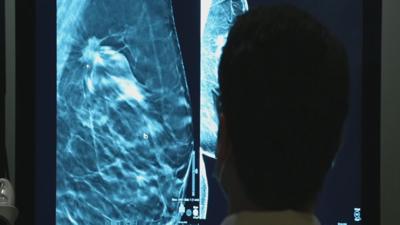 CERVICAL CANCER AWARENESS