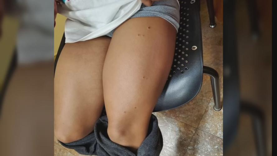 11-year-old grazed by bullets during 7th and Hill shooting 3-9-21.jpeg